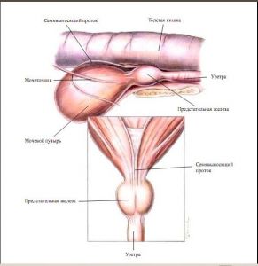 prostatitis1